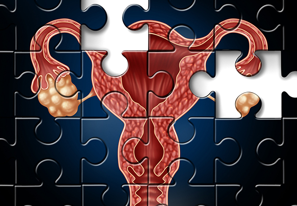 子宮內(nèi)膜異位癥