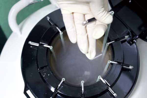 我院冷凍胚胎凍存費用優(yōu)惠政策詳解!